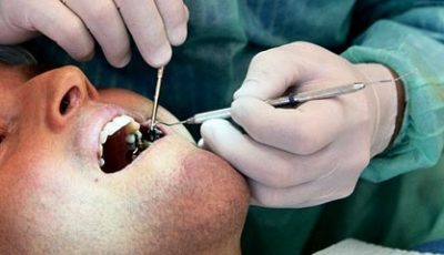 imgi_3_zasebnazobnaordinacijaemilijazivkovicdrdentmed3-1465570009